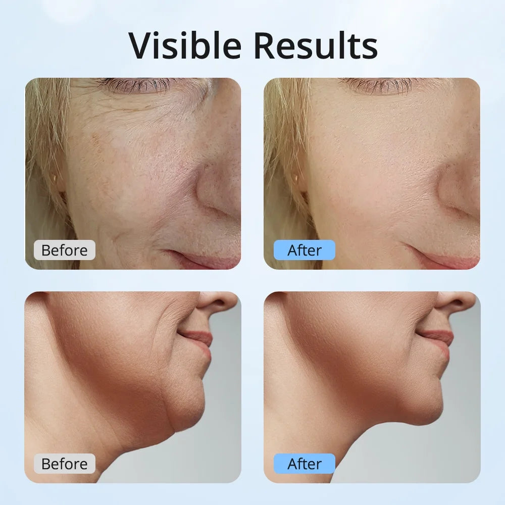 7-Color LED Neck Tightening & Facial Lifting Device – 3-in-1 Anti-Aging Skin Care Tool