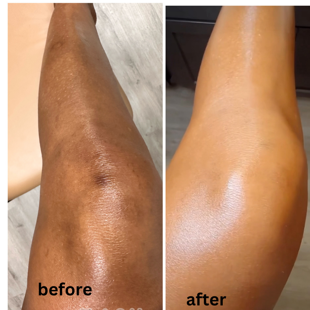 Luminous Glow Beautifying Lotion — Brightening Body Milk for Scars & Hyperpigmentation