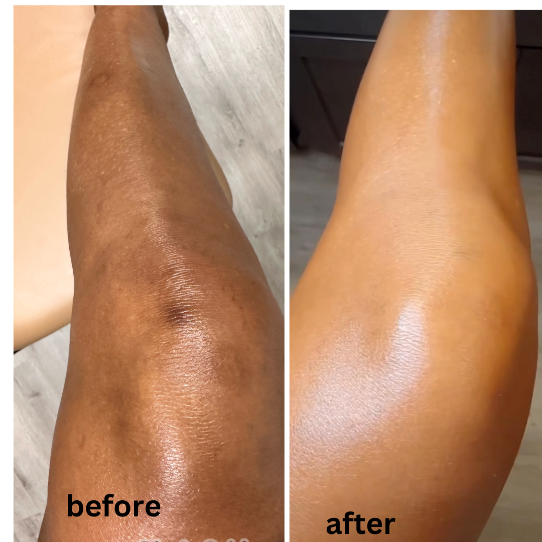 Luminous Glow Beautifying Lotion — Brightening Body Milk for Scars & Hyperpigmentation
