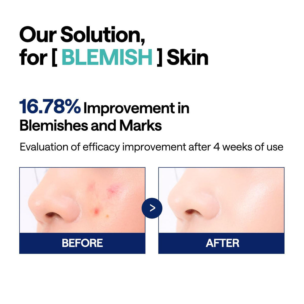 Madecassoside Toner Pads – Centella Asiatica Blemish & Uneven Tone Treatment Pads