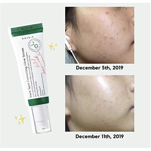 AXIS-Y Dark Spot Correcting Glow Serum – Targeted Brightening Korean Serum