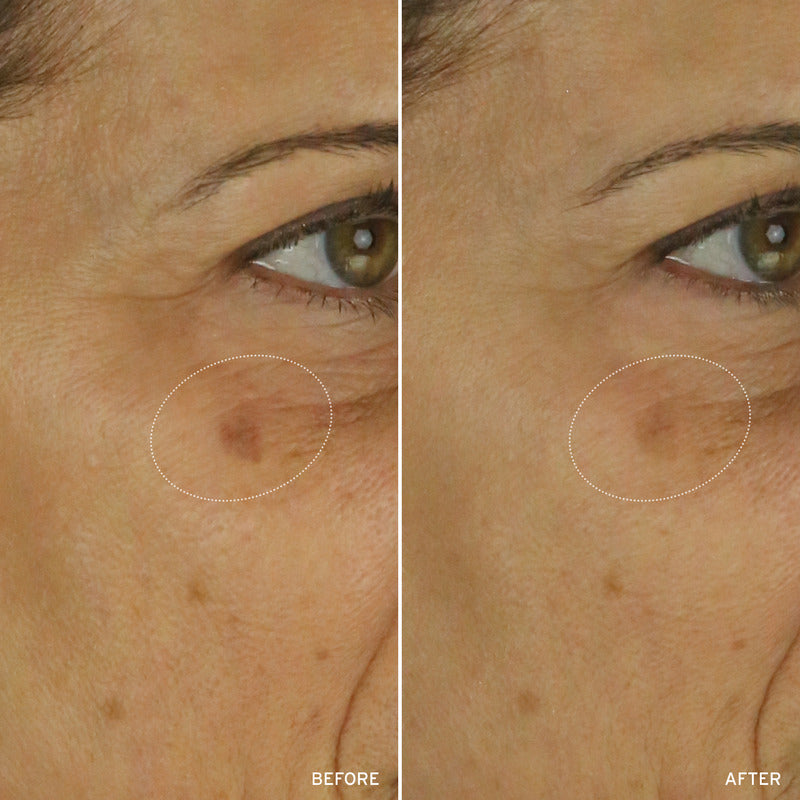 NAD+ Cell Energizing Treatment – Longevity Anti-Aging Skin Treatment
