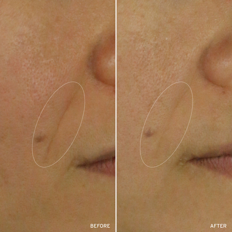 NAD+ Cell Energizing Treatment – Longevity Anti-Aging Skin Treatment