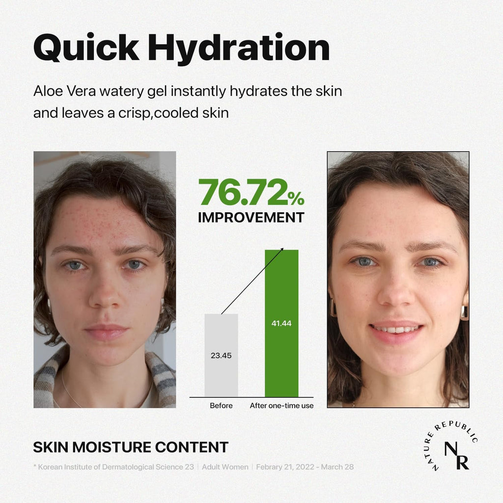 Nature Republic Aloe Vera 92% Soothing Gel – Multi-Use Hydrating Gel for Face, Hair & Body