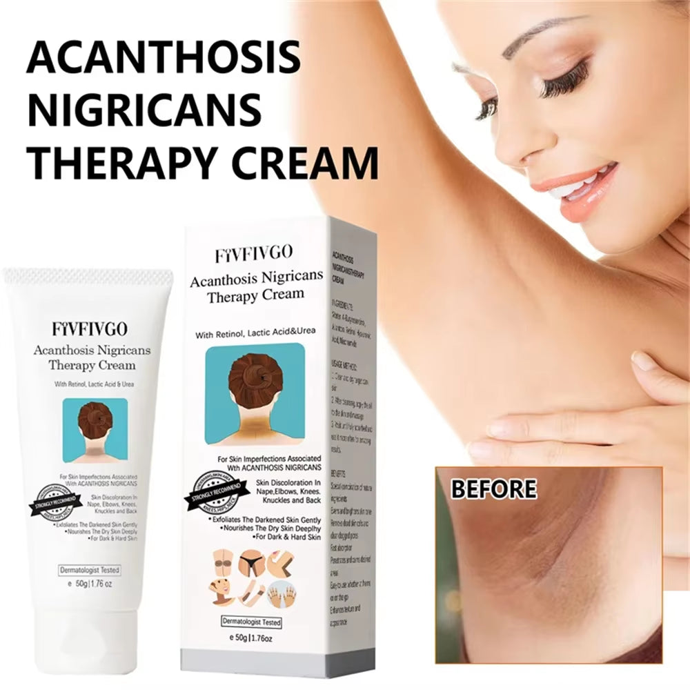 Underarm & Body Brightening Cream – Korean Moisturizing Skin Care for Dark Areas 50g