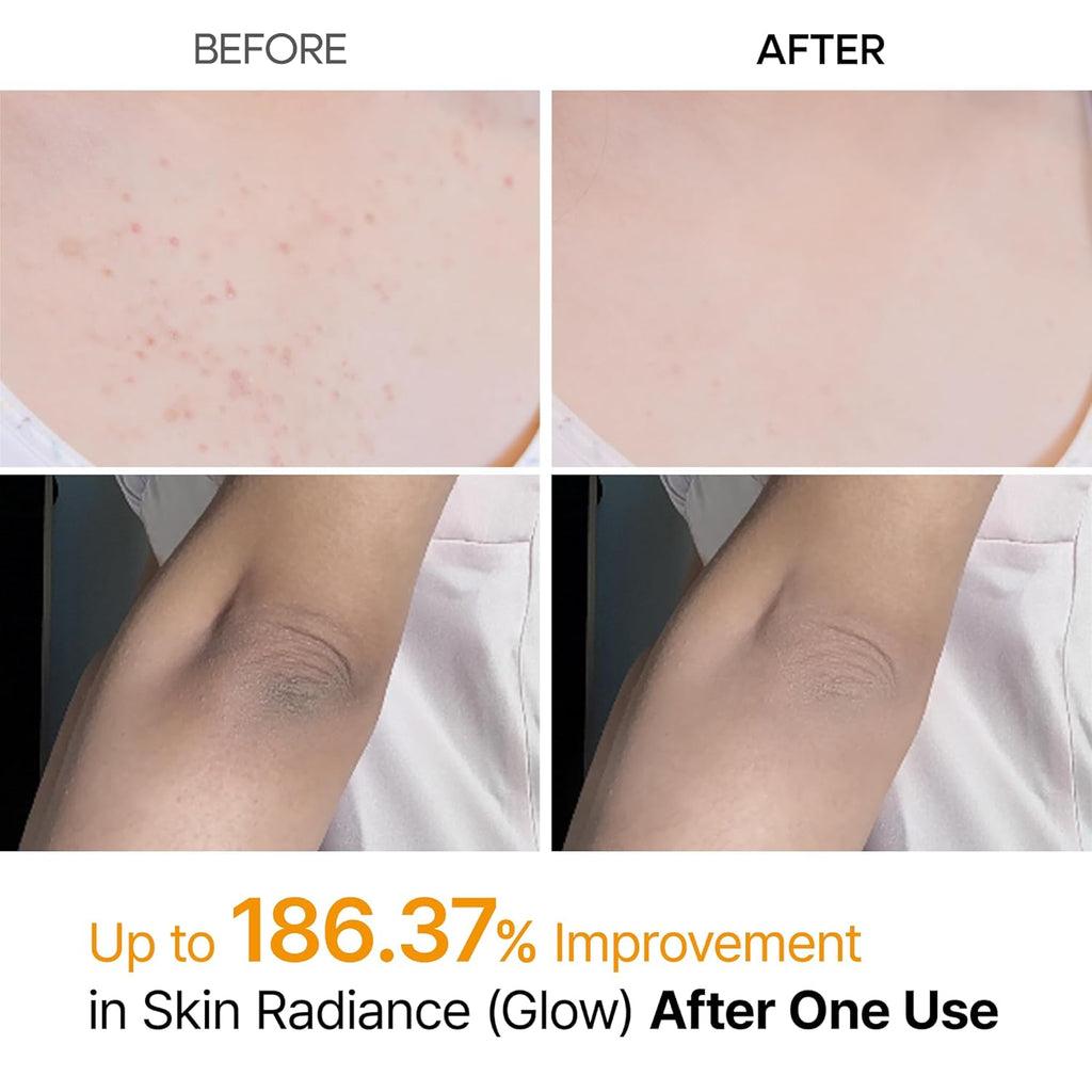 Dr. Melaxin Peel Shot Exfoliating Spray – Kojic Acid & Turmeric Brightening Exfoliant