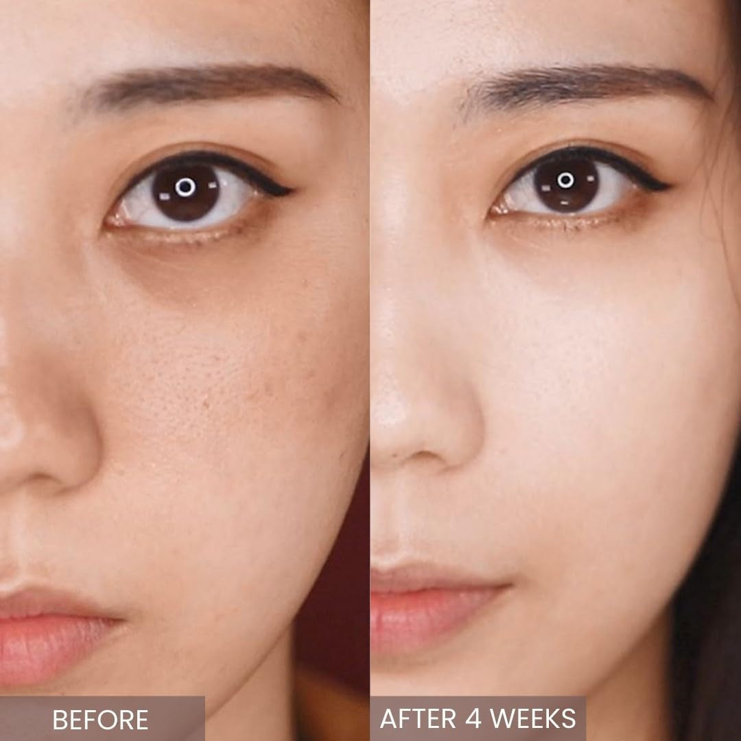 Korean Retinol Serum & Skin Moisturizer – Anti-Aging Facial Treatment