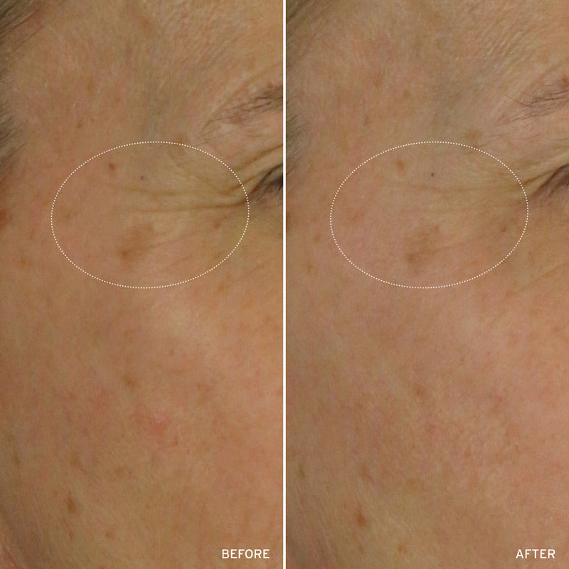 NAD+ Cell Energizing Treatment – Longevity Anti-Aging Skin Treatment