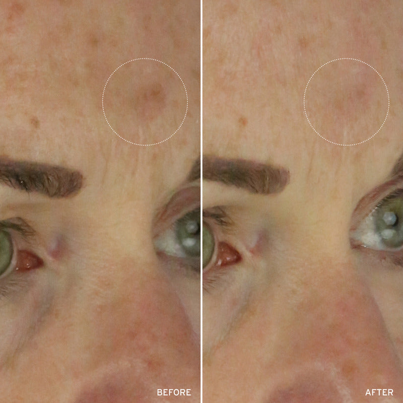 NAD+ Cell Energizing Treatment – Longevity Anti-Aging Skin Treatment