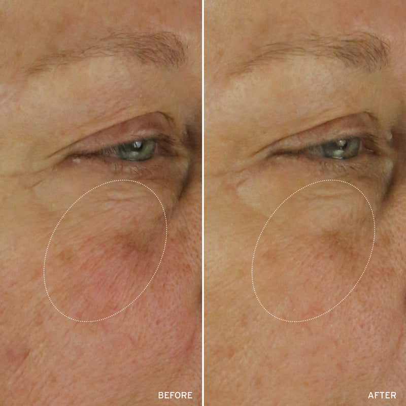 NAD+ Cell Energizing Treatment – Longevity Anti-Aging Skin Treatment