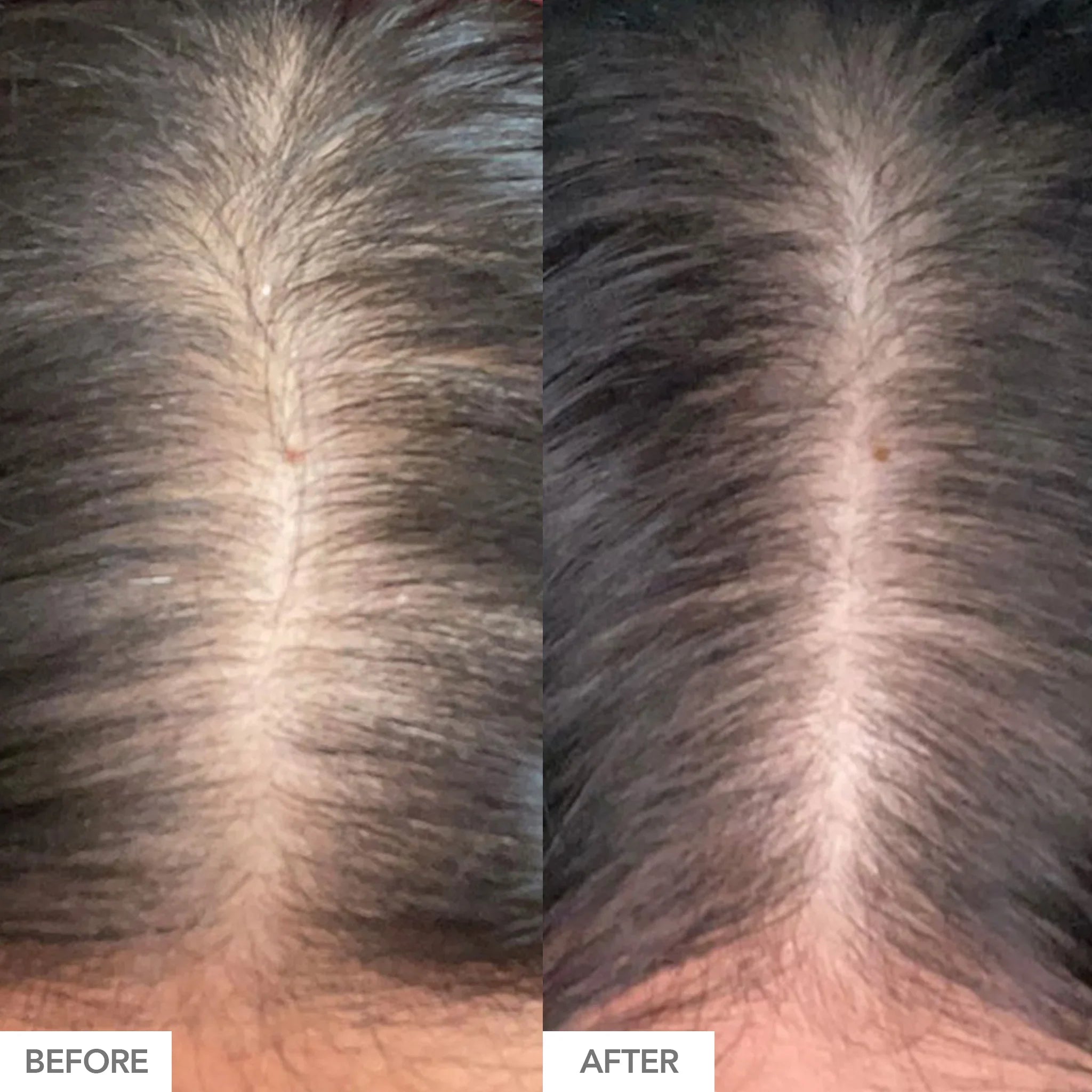 Advanced Formula Hair Growth Vitamins