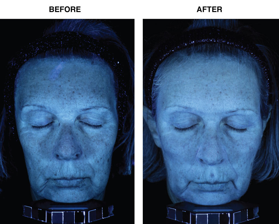 Skin Memory Serum – R·M·A Complex™ Cellular Renewal Serum