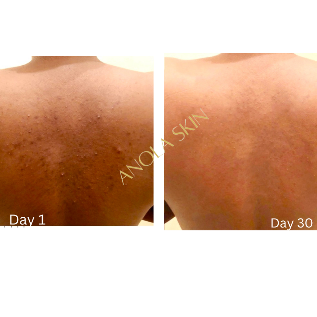 Luminous Glow Beautifying Lotion — Brightening Body Milk for Scars & Hyperpigmentation