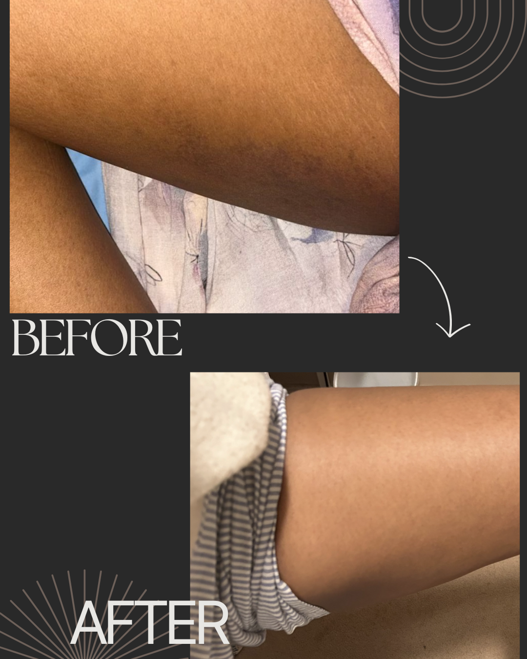 Pro-Advance Lightening Body Lotion — Maximum Efficacy Brightening Treatment