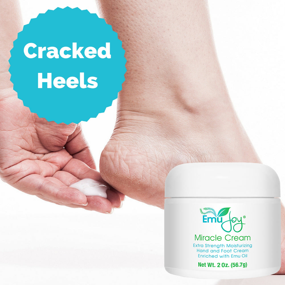 Miracle Cream — Intensive Repair Cream for Calluses, Heels & Rough Skin