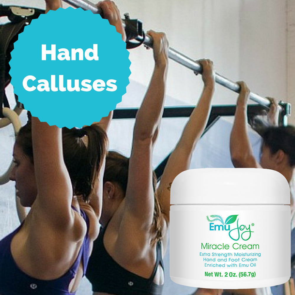 Miracle Cream — Intensive Repair Cream for Calluses, Heels & Rough Skin
