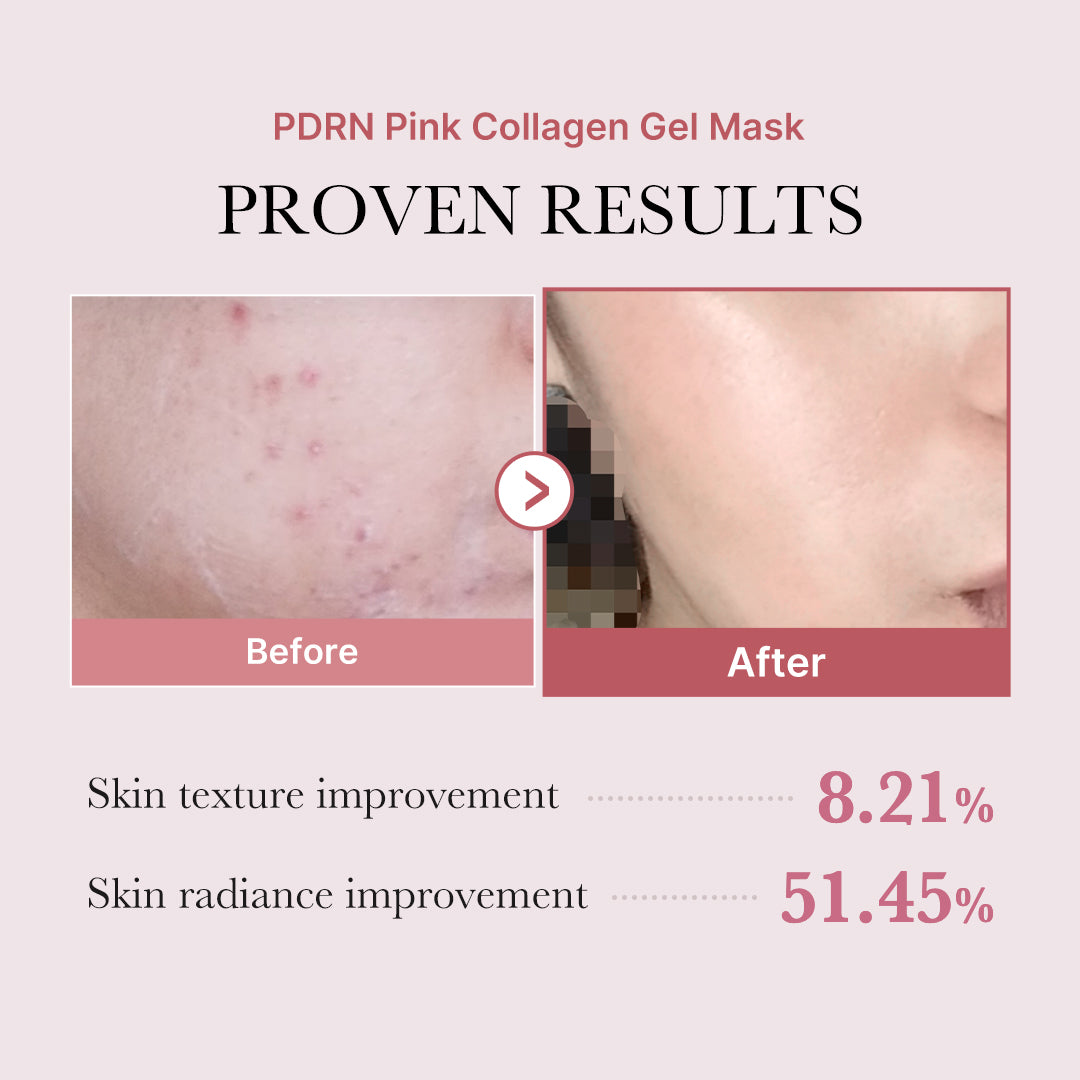 Salmon PDRN Pink Collagen Jelly Gel Mask – Korean Regenerative Face Mask