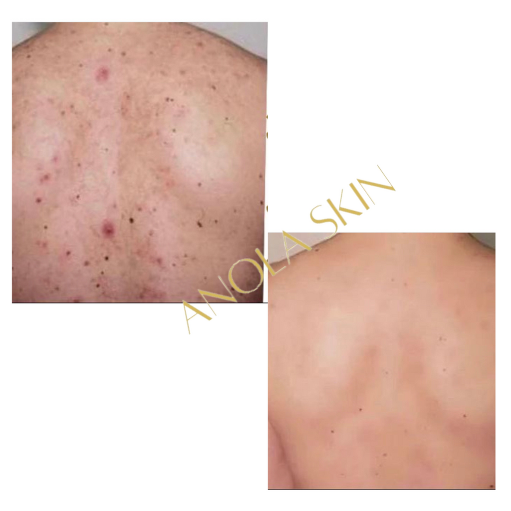 Luminous Glow Beautifying Lotion — Brightening Body Milk for Scars & Hyperpigmentation