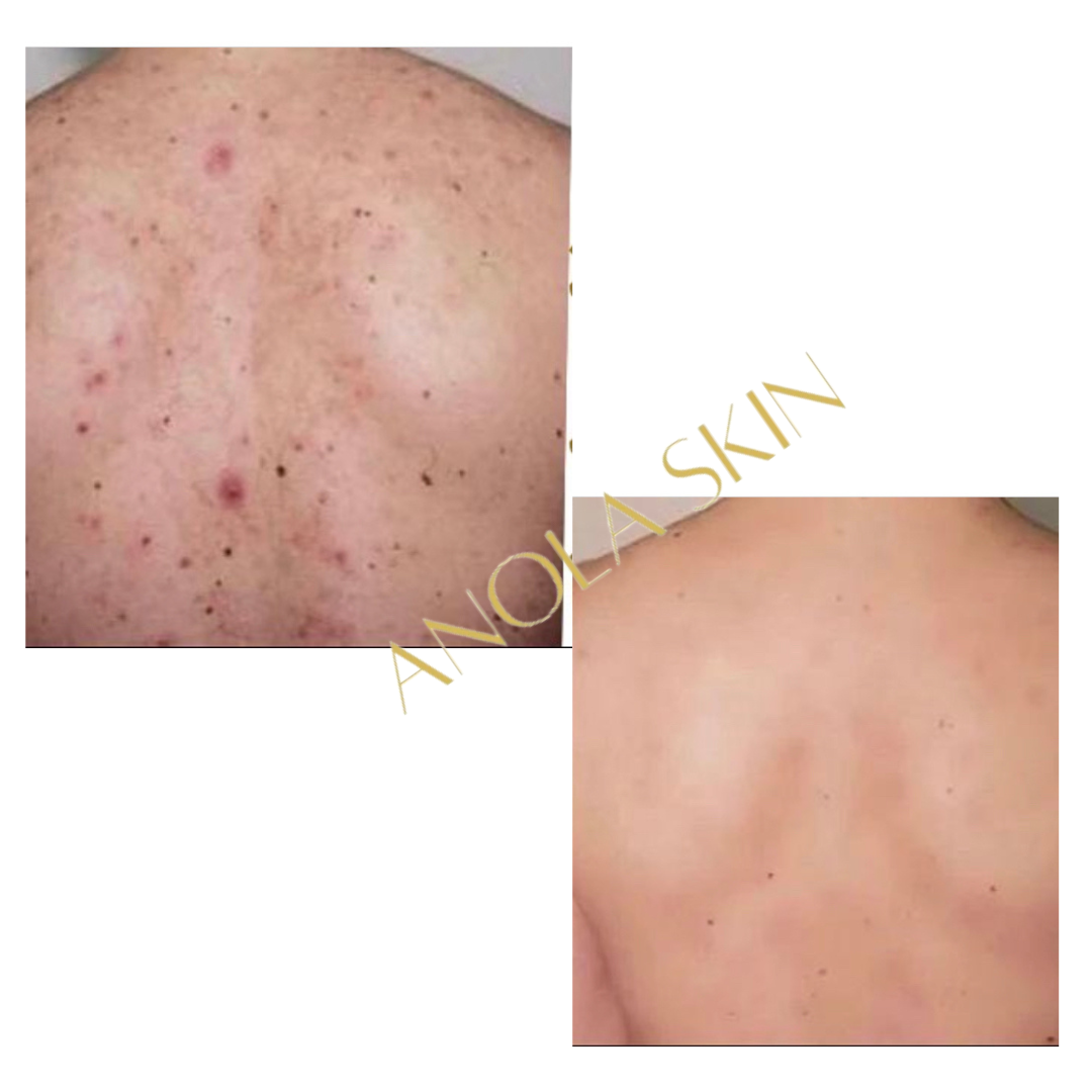 Luminous Glow Beautifying Lotion — Brightening Body Milk for Scars & Hyperpigmentation