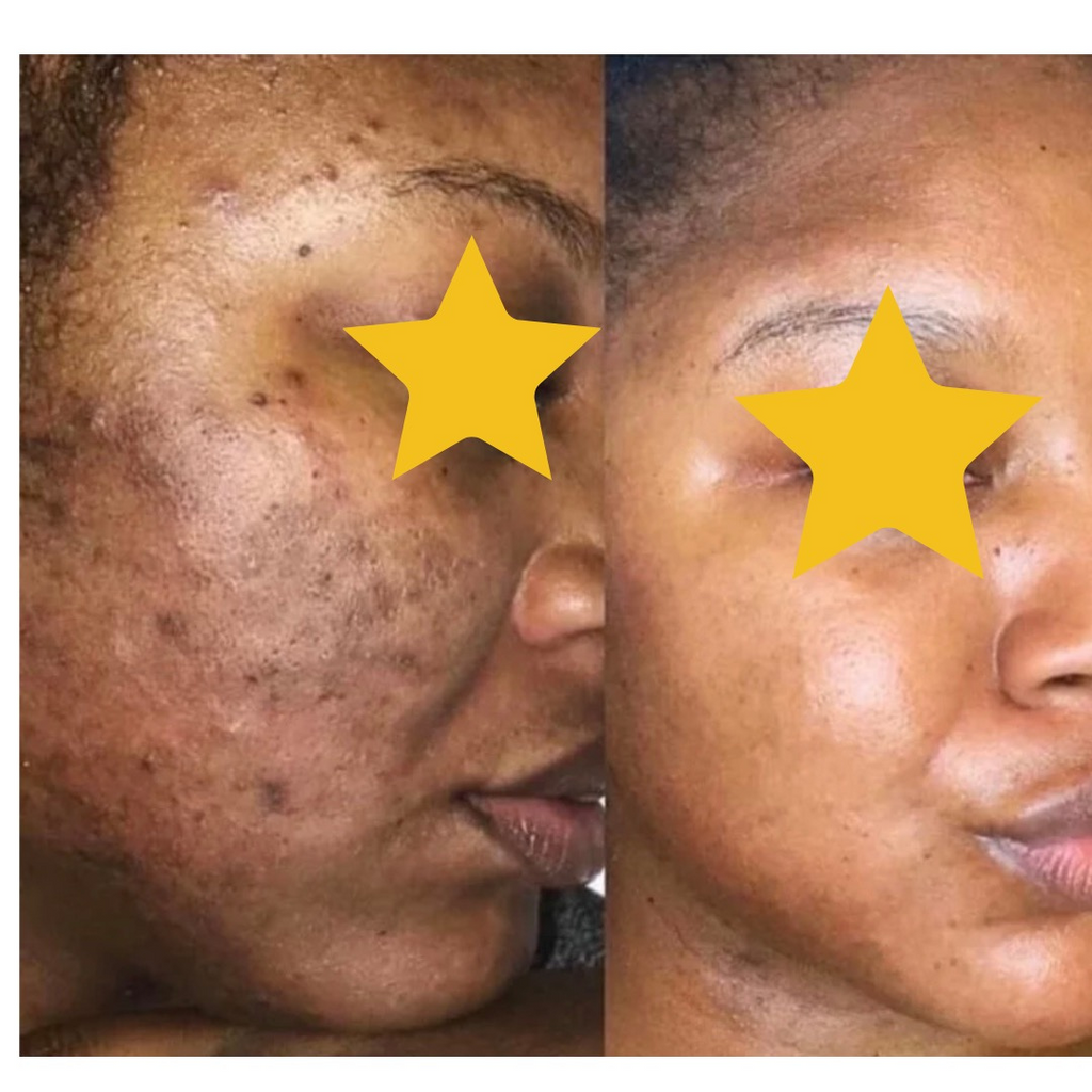 Skin Revive Lightening Cream — Dark Spot & Hyperpigmentation Treatment