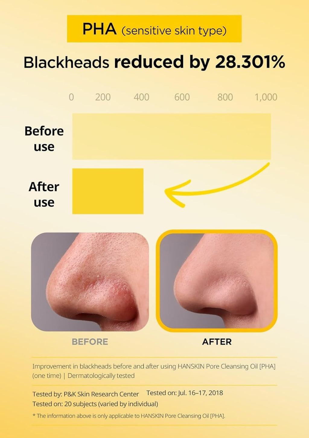Hanskin Pore Cleansing Oil – PHA Makeup & Blackhead Remover for Sensitive Skin 10.14 oz