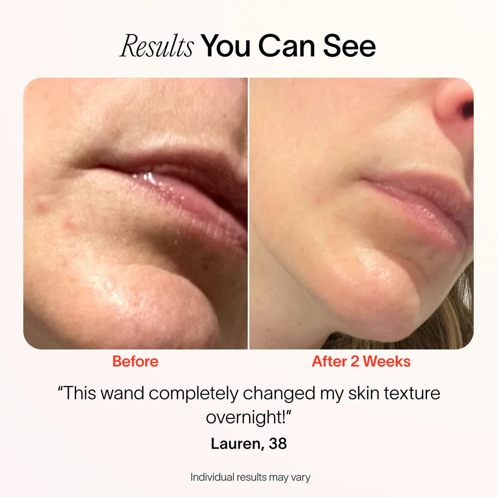 4-in-1 Radiant Renewal Skincare Wand – Red Light Therapy, EMS & Microcurrent Device