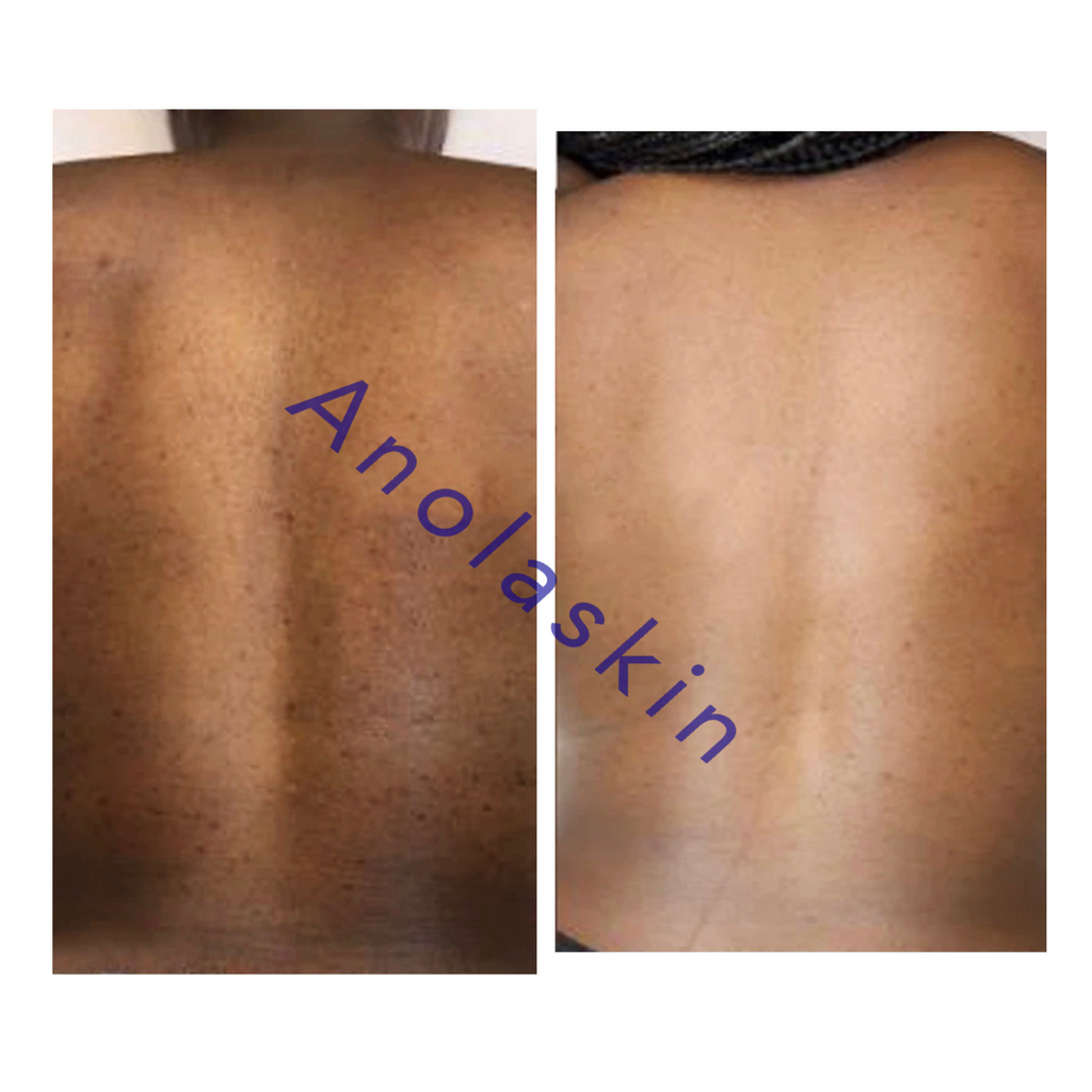 Luminous Glow Beautifying Lotion — Brightening Body Milk for Scars & Hyperpigmentation
