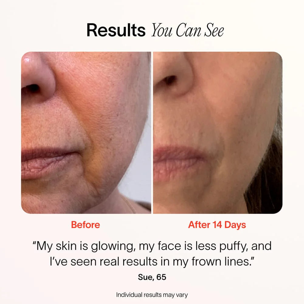 4-in-1 Radiant Renewal Skincare Wand – Red Light Therapy, EMS & Microcurrent Device