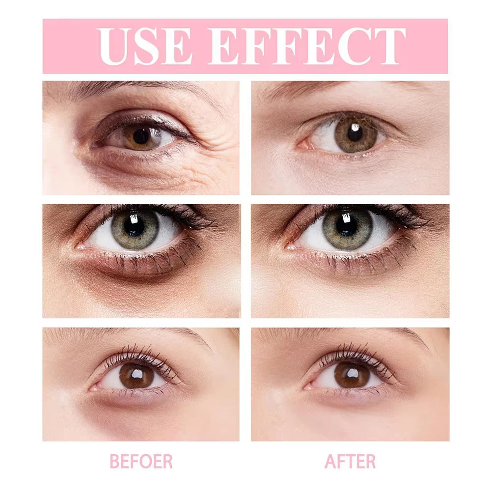 Retinol Eye Cream Stick – Korean Anti-Aging Eye Treatment for Dark Circles & Wrinkles