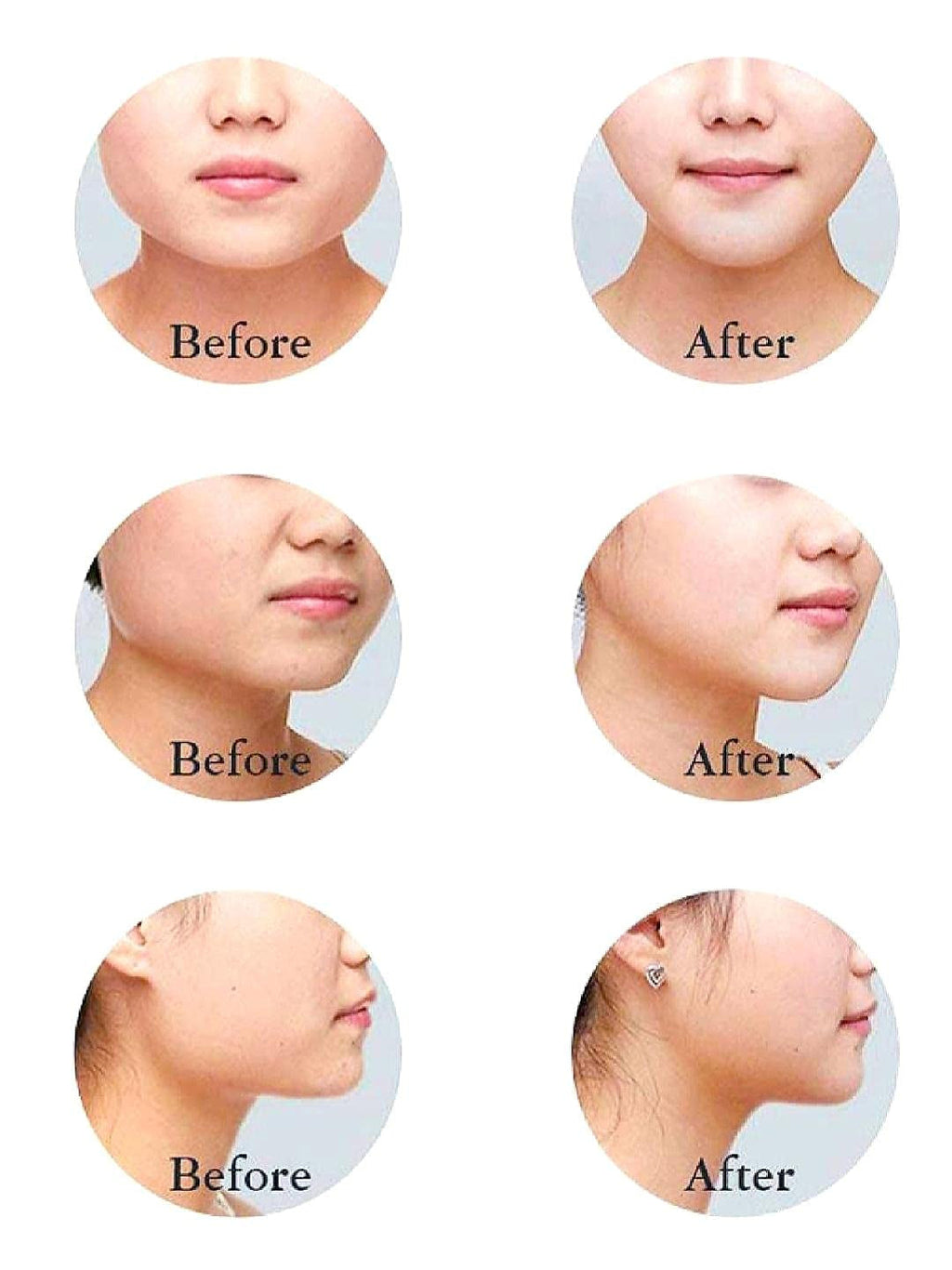 V-Line Face Slimming Band – Jawline Contouring & Double Chin Reducer Strap