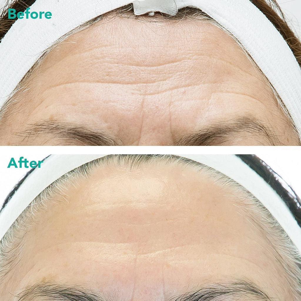 Advanced Anti-Aging Retinol + C-PDRN Serum – Firming & Radiance Booster 1.01 oz