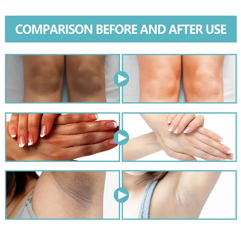 Underarm & Body Brightening Cream – Korean Moisturizing Skin Care for Dark Areas 50g