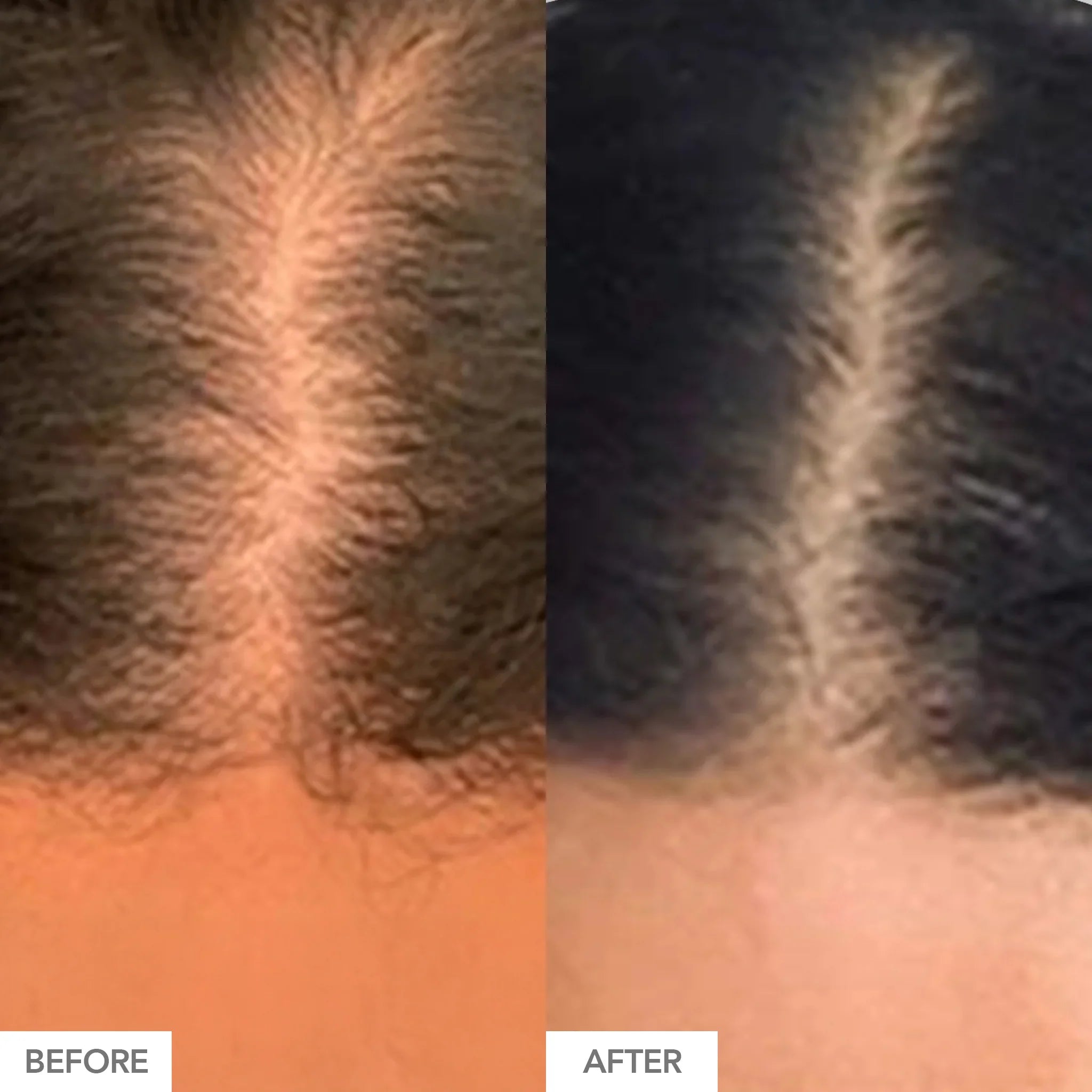 HAIRtamin Gummy Stars - Hair Growth Vitamins with 5000mcg Biotin