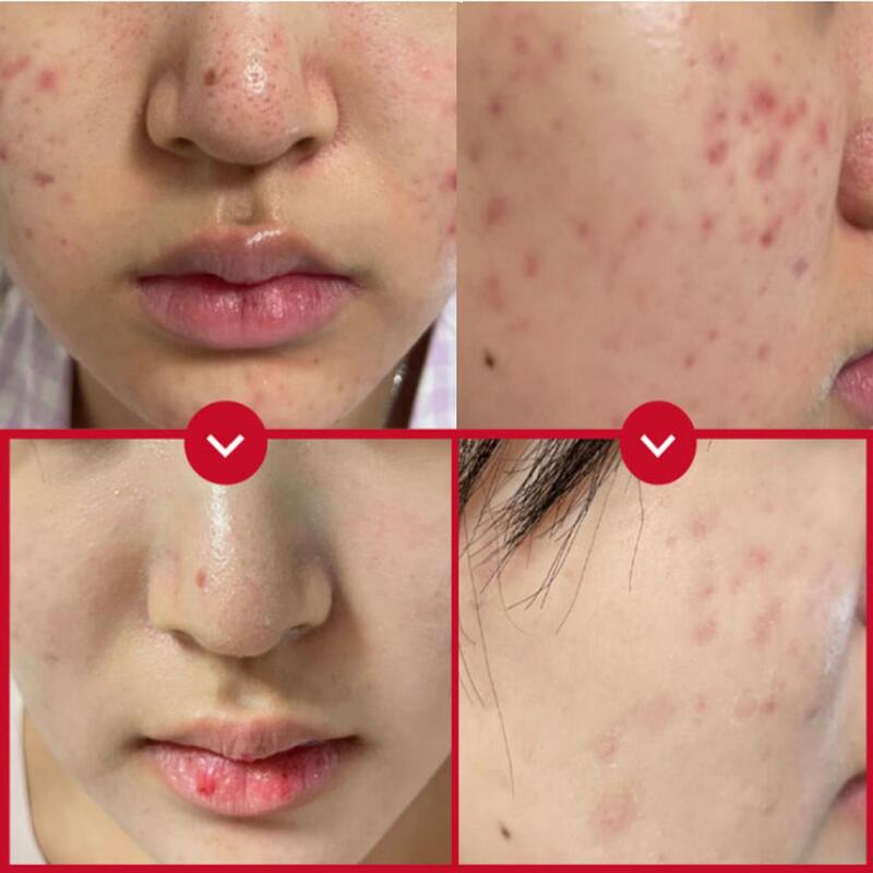 [VENDERMA] Red Calming Cica Exo Soothing Cream 50ml