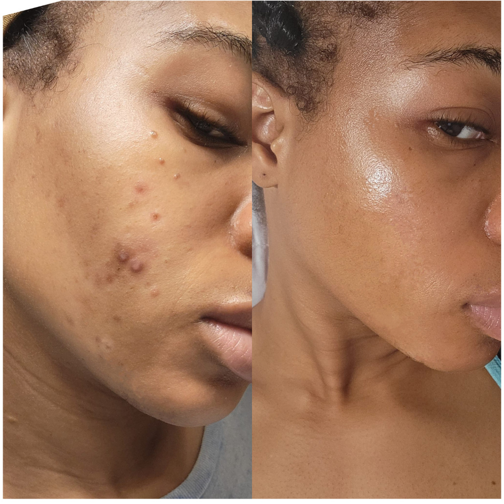 Skin Revive Lightening Cream — Dark Spot & Hyperpigmentation Treatment